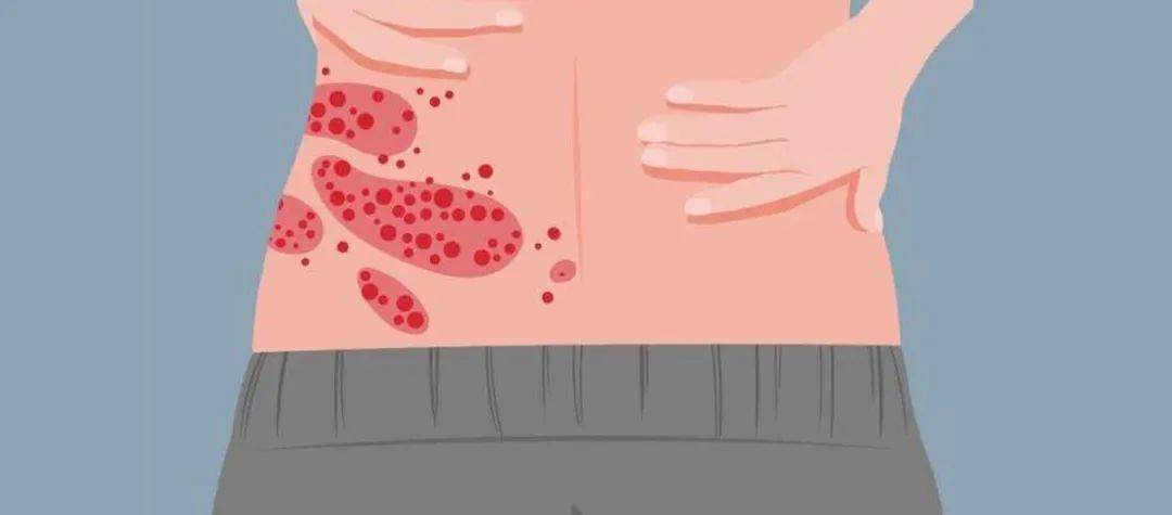 一旦感染终身携带<strong></p>
<p>哪些虚拟币靠谱</strong>！深圳疾控提醒：这4类人要注意