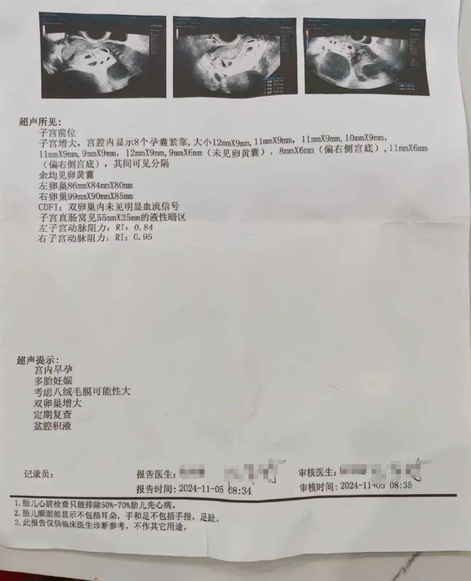 怀上9胞胎女子今日进行减胎手术：分两次进行<strong></p>
<p>哪些虚拟币靠谱</strong>，第一次减去四个胚胎，第二次减去三个