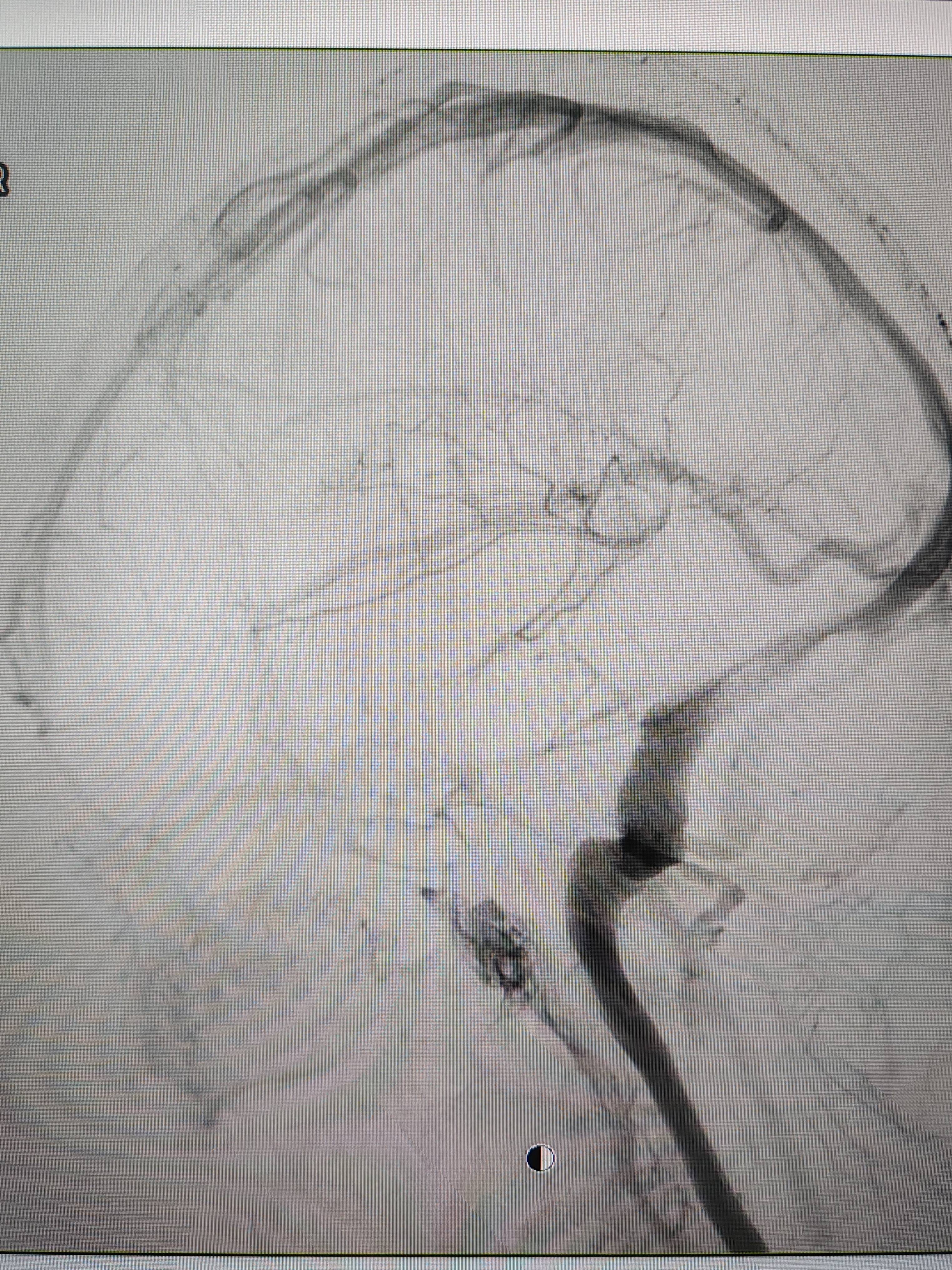 吉林女子患罕见耳鸣7年<strong></p>
<p>虚拟币交易技巧</strong>，慕名千里来顺德寻医终获新生