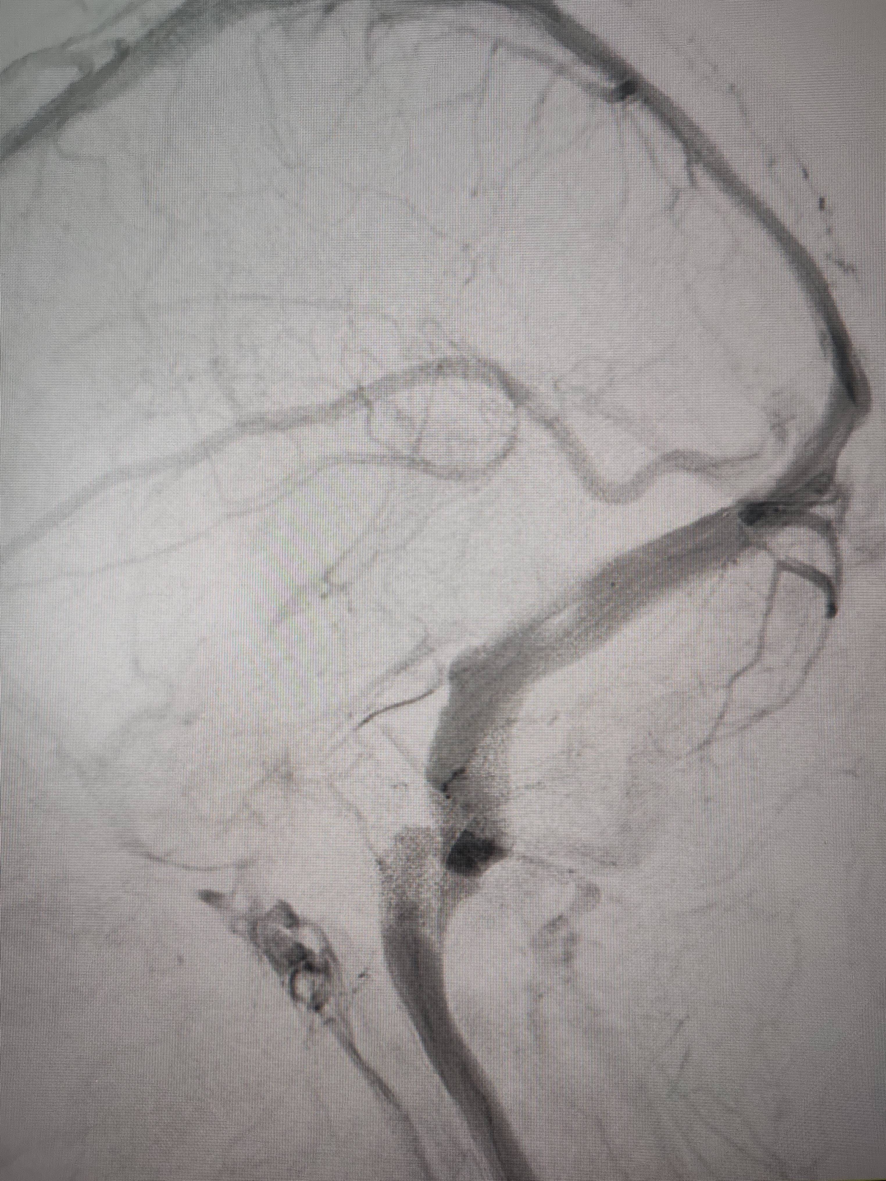 吉林女子患罕见耳鸣7年<strong></p>
<p>虚拟币交易技巧</strong>，慕名千里来顺德寻医终获新生