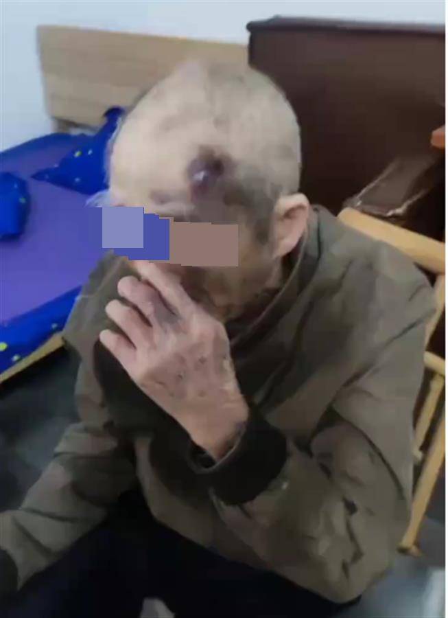 广东阳江一养老院护工长期虐待九旬老人？民政局已介入<strong></p>
<p>虚拟币挖矿程序原理</strong>，警方：正了解情况