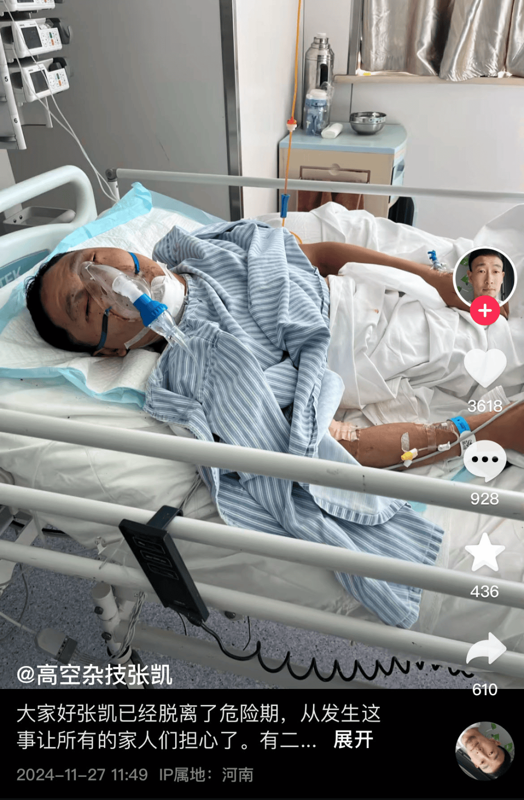 河南一杂技演员表演时绳子断裂坠落，直播间千人目睹，知情人：妻子去年发生意外去世