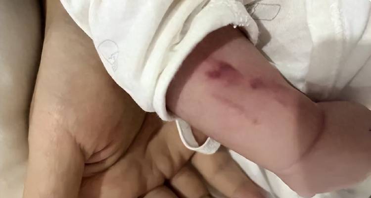 广西一男婴在月子中心被照料20天：身上2处骨折<strong></p>
<p>虚拟币挖矿程序原理</strong>，育婴室监控无法查看