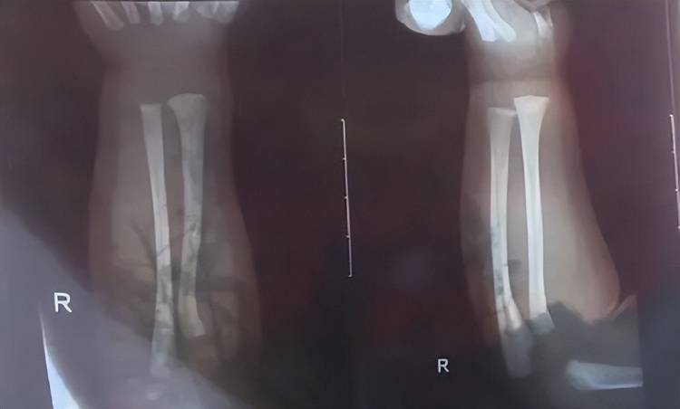 广西一男婴在月子中心被照料20天：身上2处骨折<strong></p>
<p>虚拟币挖矿程序原理</strong>，育婴室监控无法查看