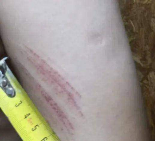 侄女与姑姑争祖父留下的门面<strong></p>
<p>原油最新走势</strong>，长沙租客“躺枪”：我被打了，店也被锁了！