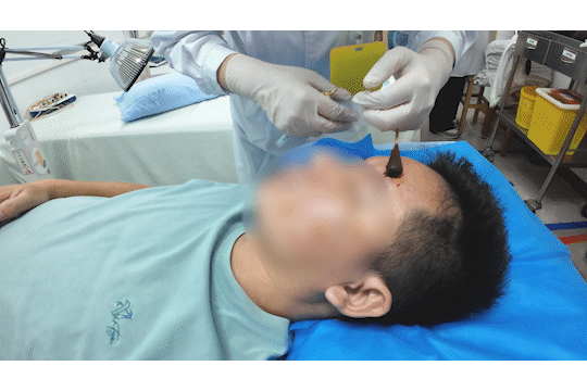 醒来“天塌了”<strong></p>
<p>国际原油行情实时行情</strong>！深圳一女子眼睛闭不上、嘴巴漏水！这些错误很多人会犯