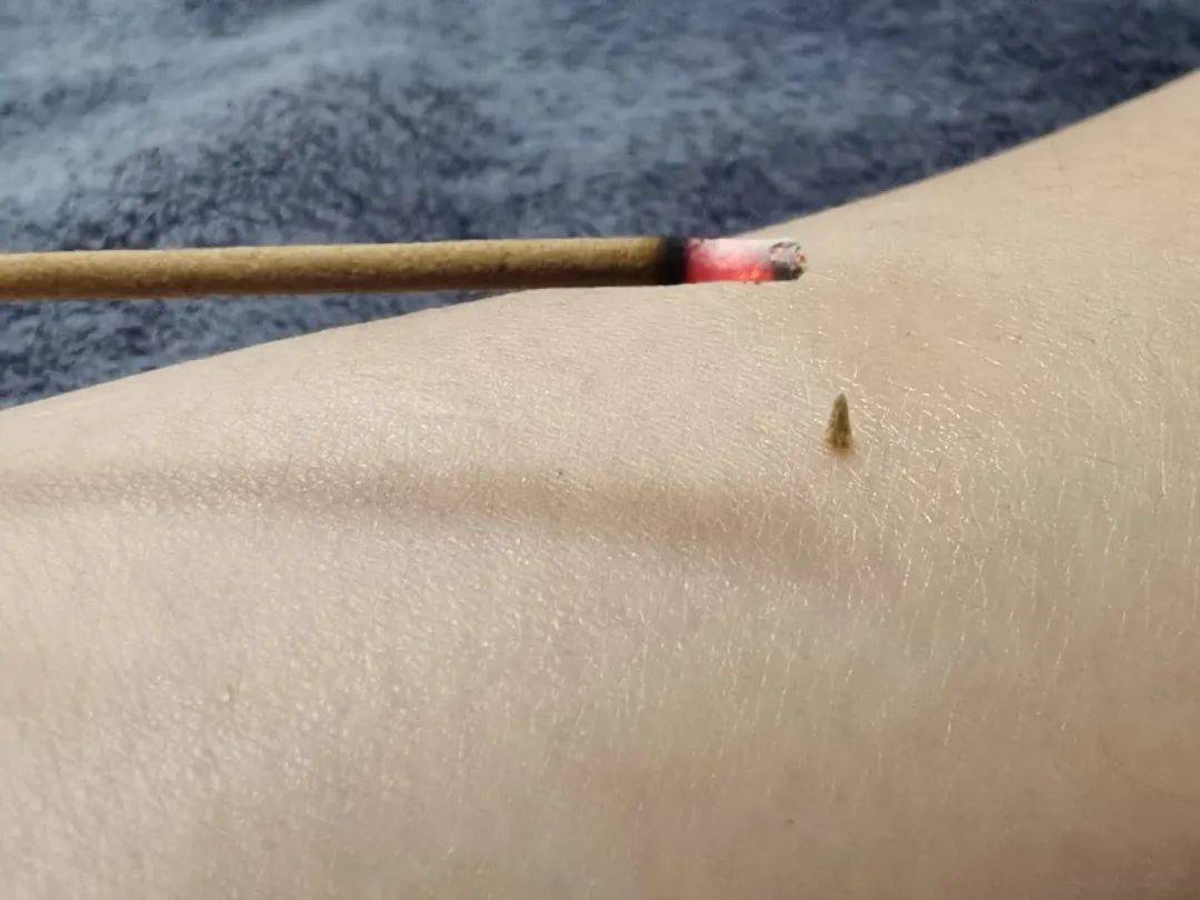 醒来“天塌了”<strong></p>
<p>国际原油行情实时行情</strong>！深圳一女子眼睛闭不上、嘴巴漏水！这些错误很多人会犯