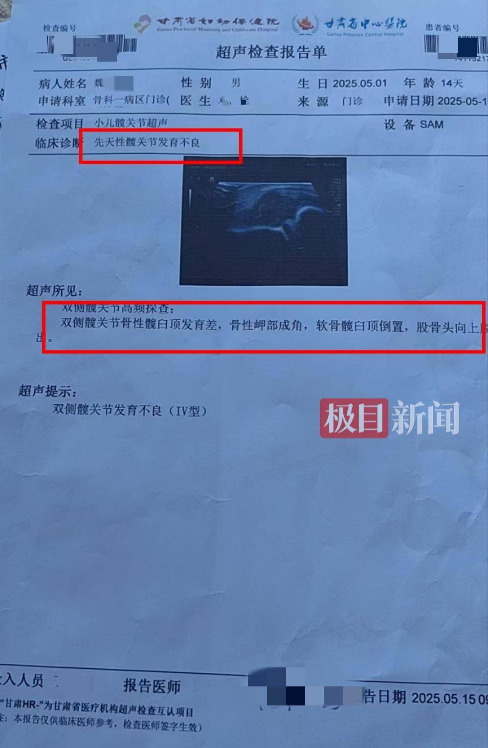 二胎出生查出先天性病症或落下残疾<strong></p>
<p>原油招聘</strong>，残疾父母称医院产检漏检、未尽告知义务，医院及医调委回应