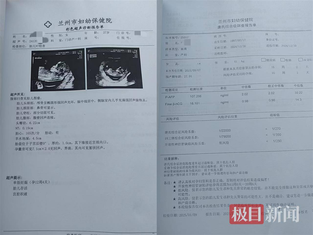 二胎出生查出先天性病症或落下残疾<strong></p>
<p>原油招聘</strong>，残疾父母称医院产检漏检、未尽告知义务，医院及医调委回应