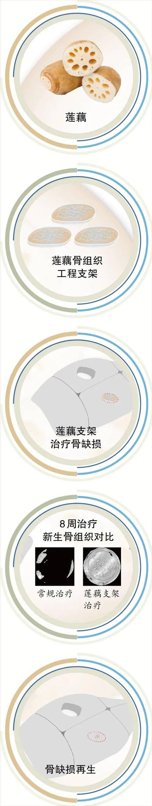 新突破！广州科研团队用莲藕接骨“塑肉身”<strong></p>
<p>原油招聘</strong>，冻豆腐、枸杞、油柑都在研究之列