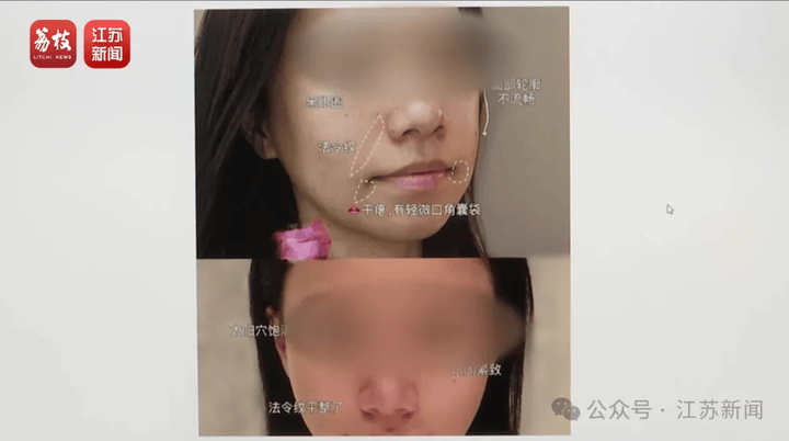 打一针“返老还童”的童颜针卖了30亿，真的有效吗？