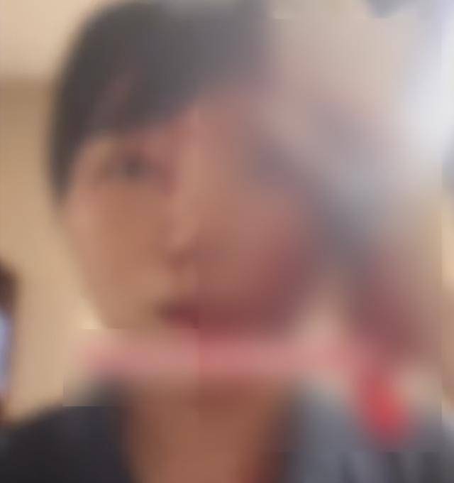 缝了20多针！女子称被不知名男同事砸头毁容<strong></p>
<p>原油提炼设备</strong>，警方介入