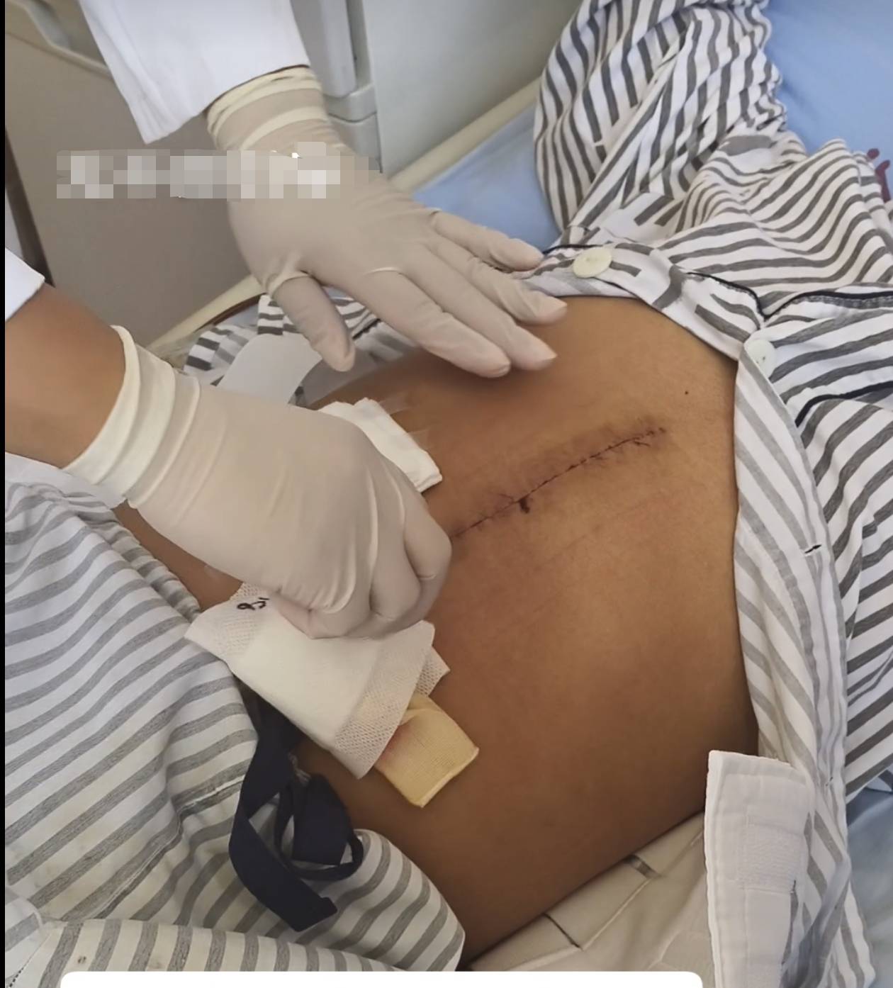 奶奶在哭<strong></p>
<p>伊朗原油产量</strong>，宝宝在笑！40天女婴重病，00后父亲割肝救女，术后这一幕让网友泪奔