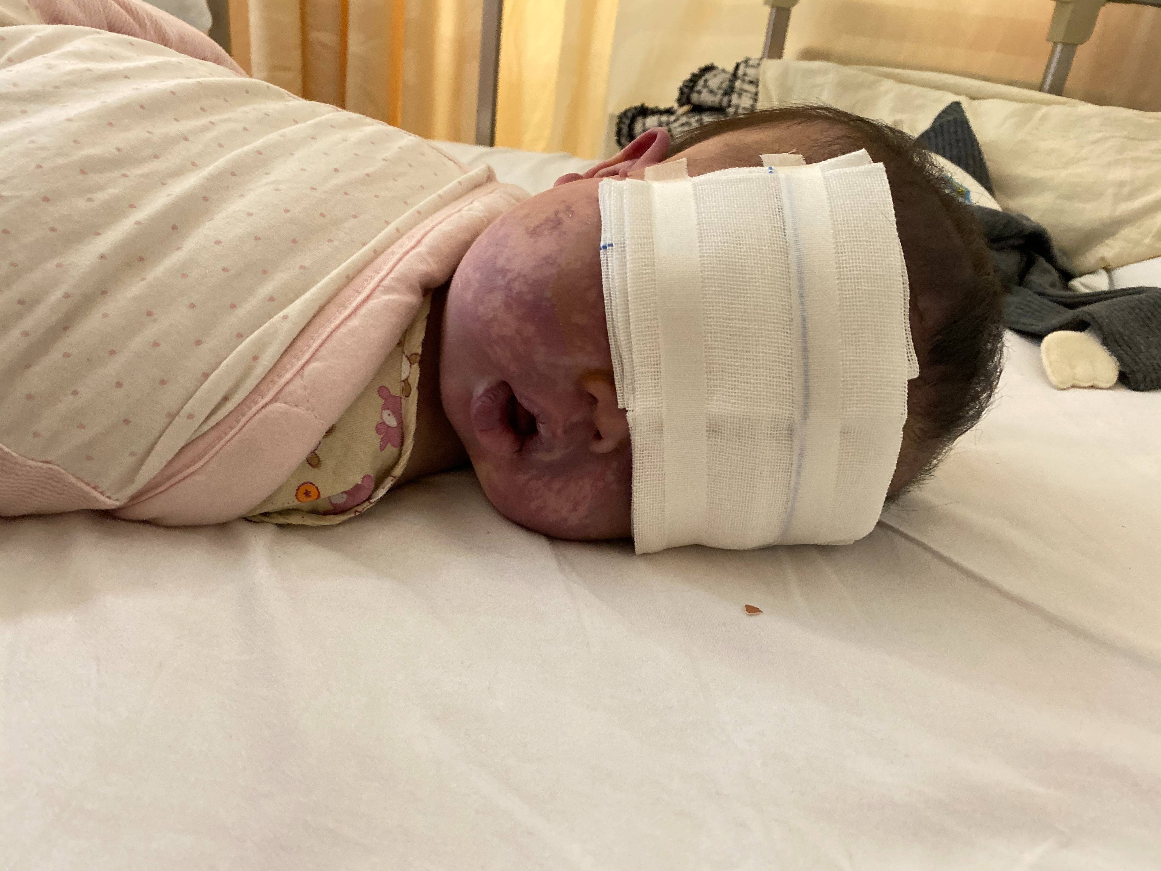 上饶6岁女童患病满身红斑<strong></p>
<p>原油期货开户流程</strong>，初上幼儿园妈妈字里行间满是担心：曾经绝望，现在能看到光