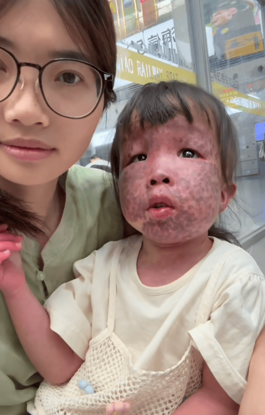 上饶6岁女童患病满身红斑<strong></p>
<p>原油期货开户流程</strong>，初上幼儿园妈妈字里行间满是担心：曾经绝望，现在能看到光