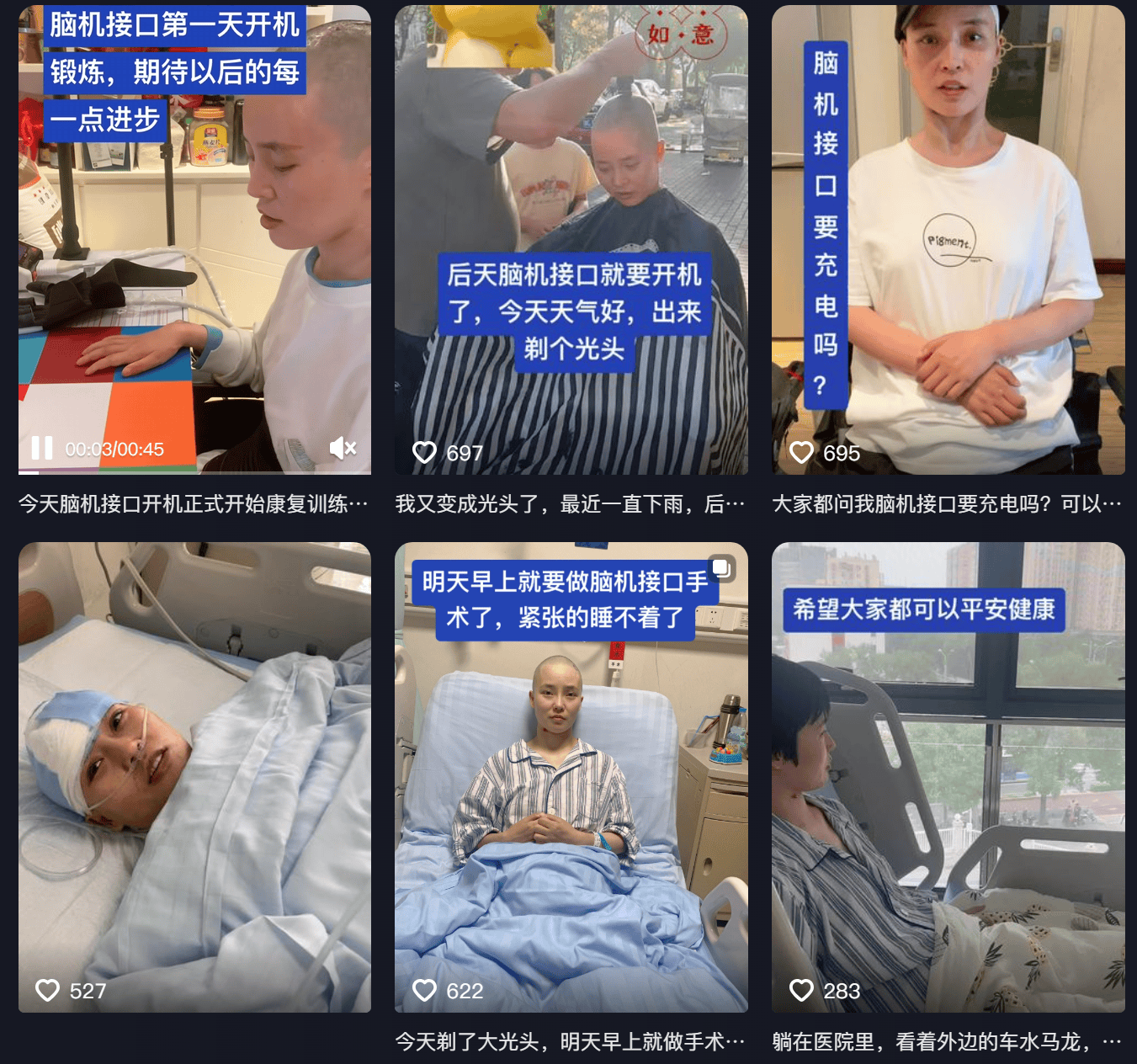 女子因车祸全身瘫痪6年仅嘴眼能动<strong></p>
<p>原油</strong>，接受脑机接口手术后通过意念抓取物品！当事人讲述