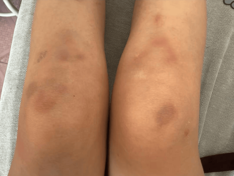 女子自称因工资问题被老板锁办公室里打 警方：双方已到派出所<strong></p>
<p>凤凰卫视资讯台节目表</strong>，是否打人还在调查