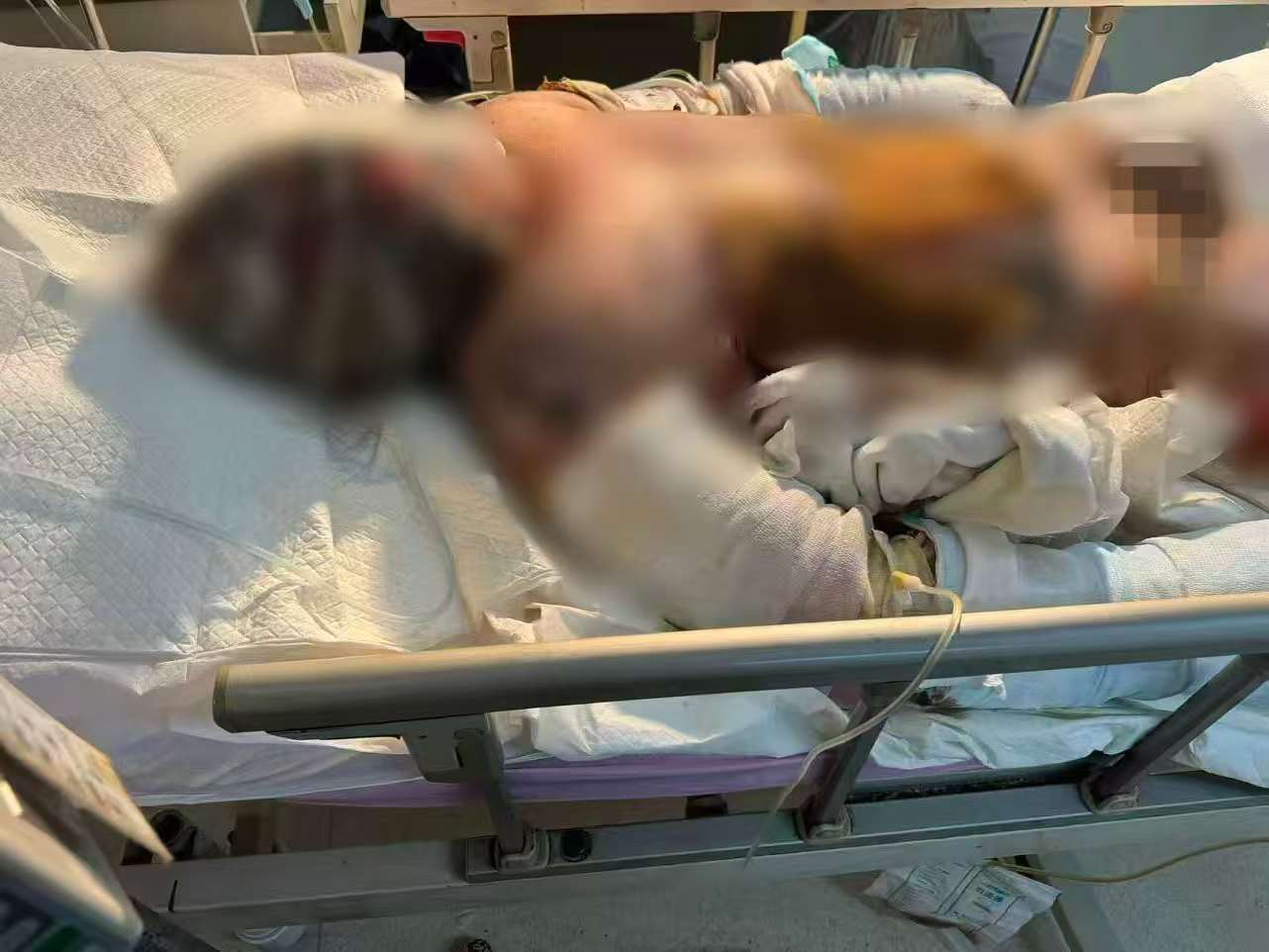 父子在哈尔滨一亲戚公司上班遇爆炸全身烧伤<strong></p>
<p>世界电影之旅</strong>，治疗花费近百万公司拒赔偿？亲戚回应