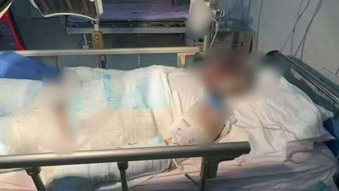 父子在哈尔滨一亲戚公司上班遇爆炸全身烧伤<strong></p>
<p>世界电影之旅</strong>，治疗花费近百万公司拒赔偿？亲戚回应