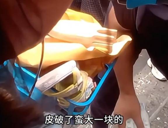 看着都疼<strong></p>
<p>新闻资讯</strong>！上海街头一男子突然求助：10岁女儿被死死卡住！这个行为太危险→