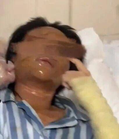 湖南一女主播被伪装的包裹炸伤<strong></p>
<p>新闻资讯</strong>，永州公安：正在核实具体情况