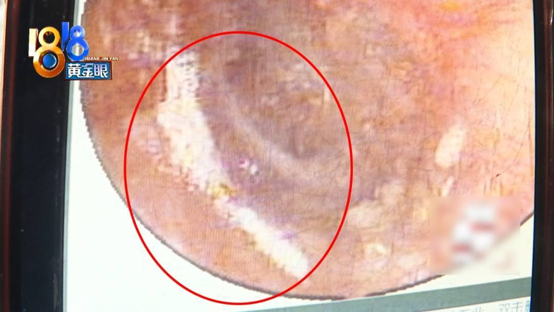 杭州姑娘痒了一整夜<strong></p>
<p>资讯点</strong>，检查结果让她崩溃……浴场回应索赔：凭什么要两千？